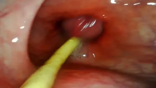 Imagen del video Cámara dentro del culo en un anal pov extremo